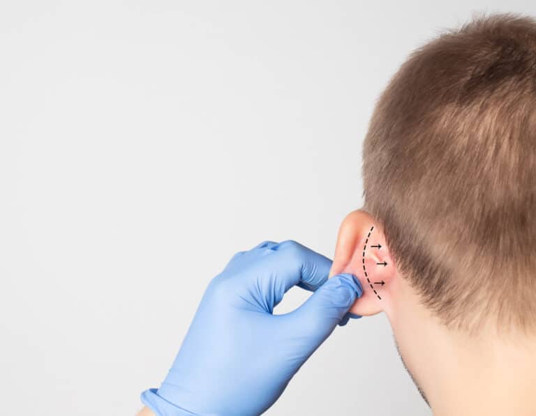 Surgeon holds child's ear